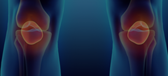 Meniscus Tear Treatment San Antonio TX